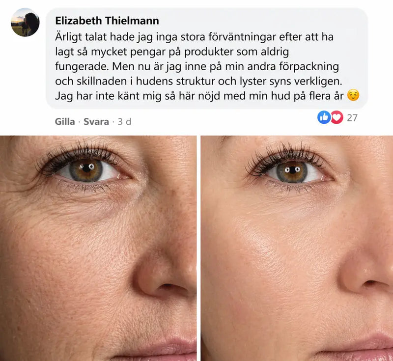 Hudförvandling 1