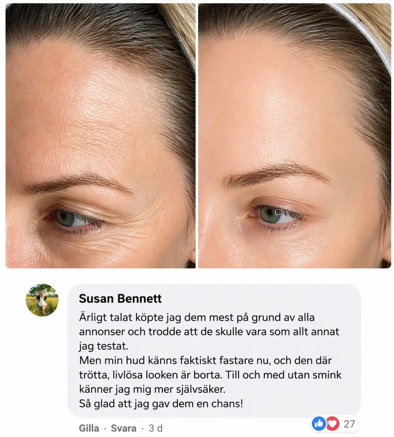 Hudförvandling 2