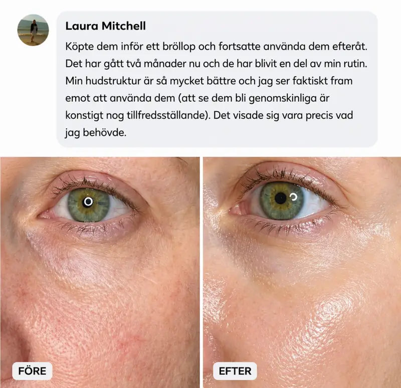 Hudförvandling 3