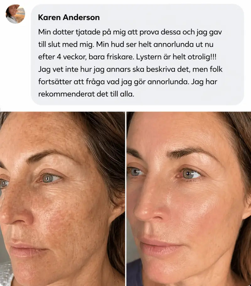 Hudförvandling 4